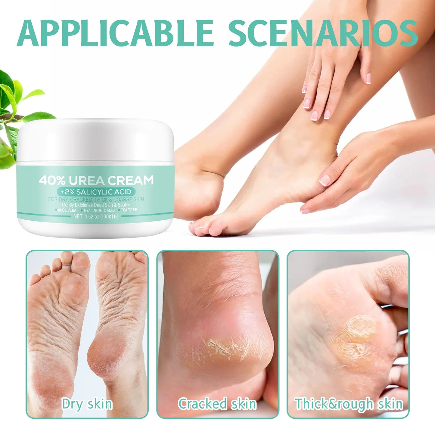 40% Urea + 2% Salicylic Acid Cream 100g for Dry Cracked Hands & Feet Deep Moisturizer Exfoliates Dead Skin Non-Greasy