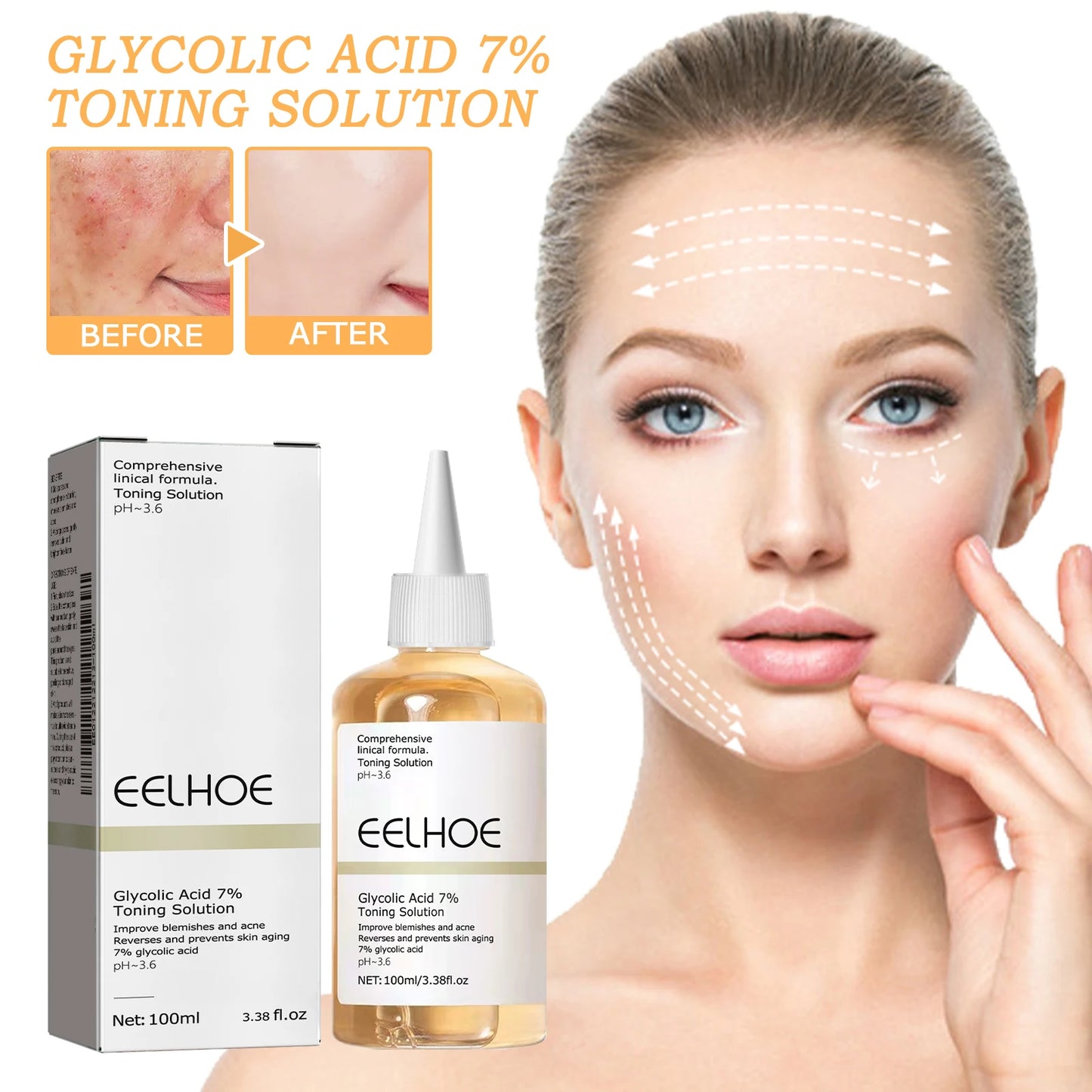 7% Glycolic Acid Toner – Acne, Blackhead Treatment, Hydrating & Skin Smoothing