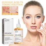 7% Glycolic Acid Toner – Acne, Blackhead Treatment, Hydrating & Skin Smoothing