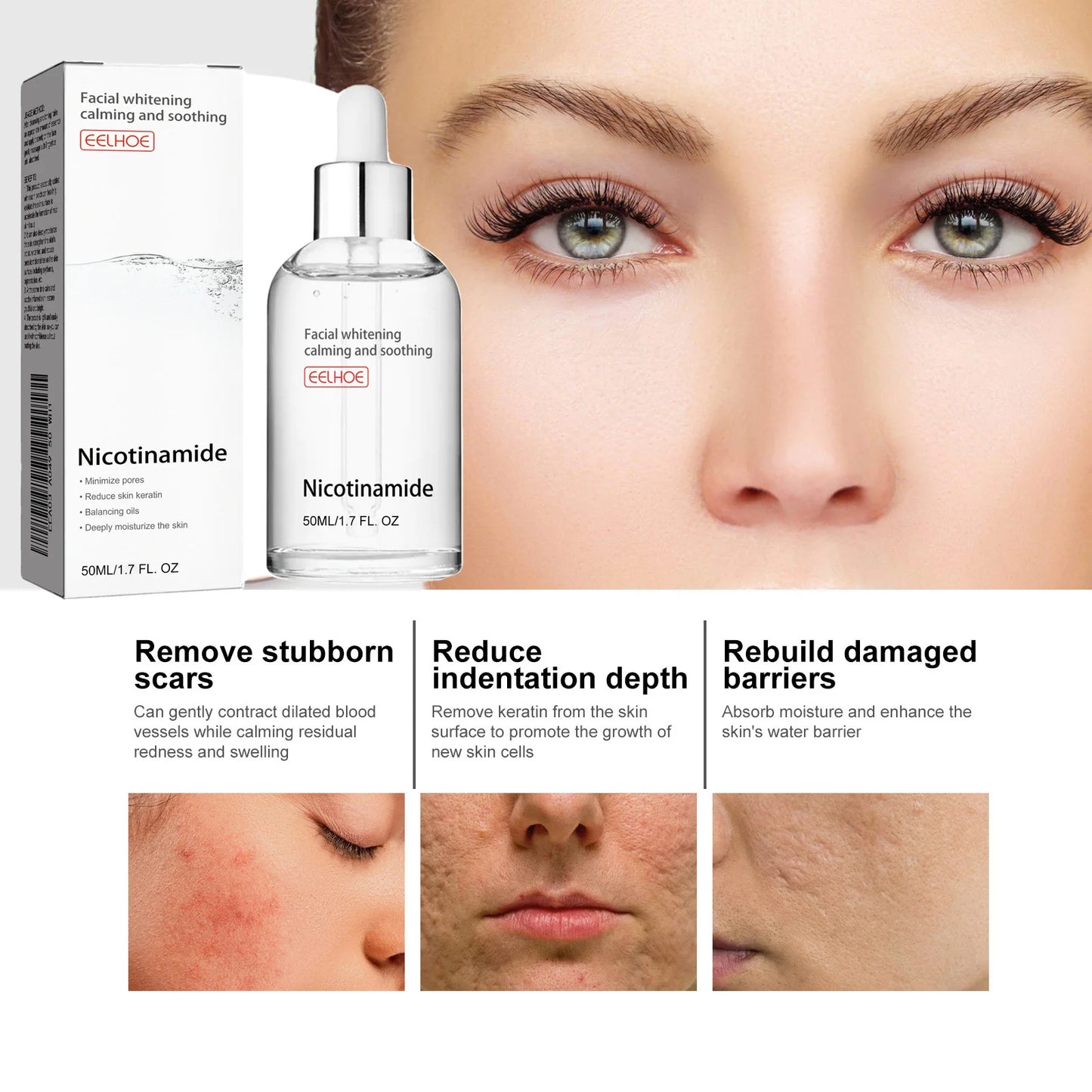 EELHOE Nicotinamide Face Serum Nourish Face Contour Facial W-hitening Shrink Pores Pigmentation Remover Skin Care Products 50ml