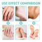 40% Urea + 2% Salicylic Acid Cream 100g for Dry Cracked Hands & Feet Deep Moisturizer Exfoliates Dead Skin Non-Greasy