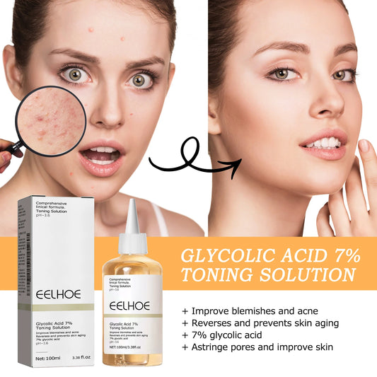 7% Glycolic Acid Toner – Acne, Blackhead Treatment, Hydrating & Skin Smoothing
