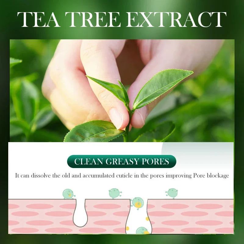 Tea Tree Acne Removing Cream – Mild Moisturizing, Oil Control & Pimples Treatment