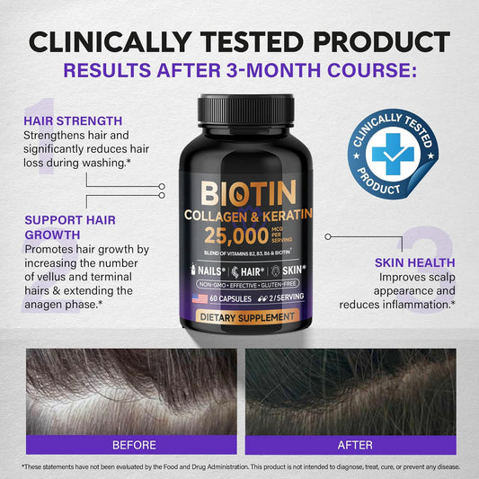 Biotin Collagen & Keratin 25000mcg – Hair Growth Support Vitamins, 60 Caps, USA Made